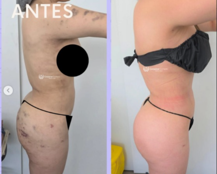 POST OPERATORIO 🎀