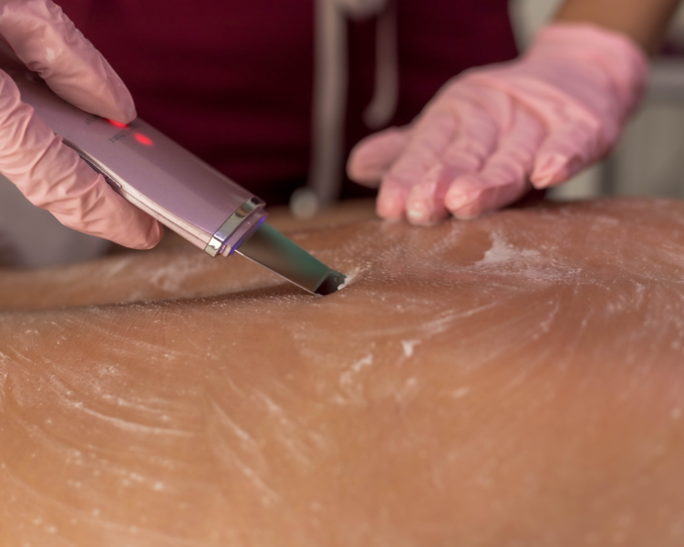 LIMPIEZA PROFUNDA DE ESPALDA