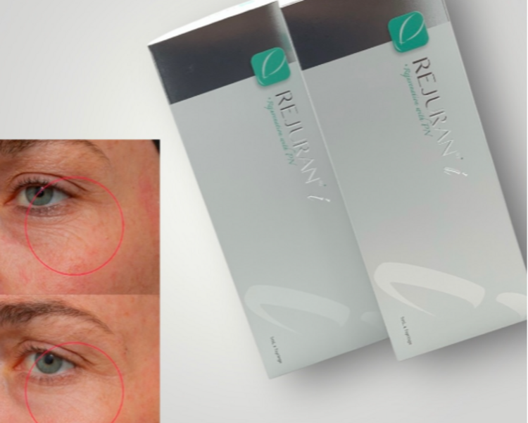 PDRN SALMON  REJURAN