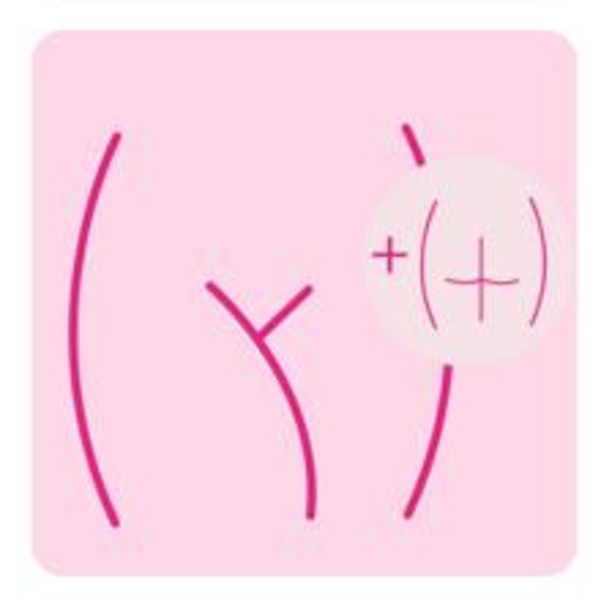 Bikini Brazilian / dama (incluye zona interglutea)