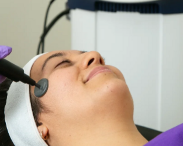 RADIOFRECUENCIA MONOPOLAR FACIAL