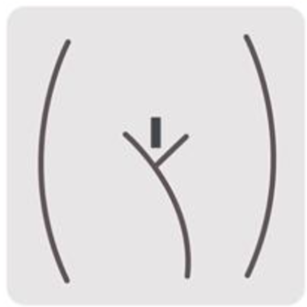 Bikini Mohican/ dama (incluye zona interglutea)