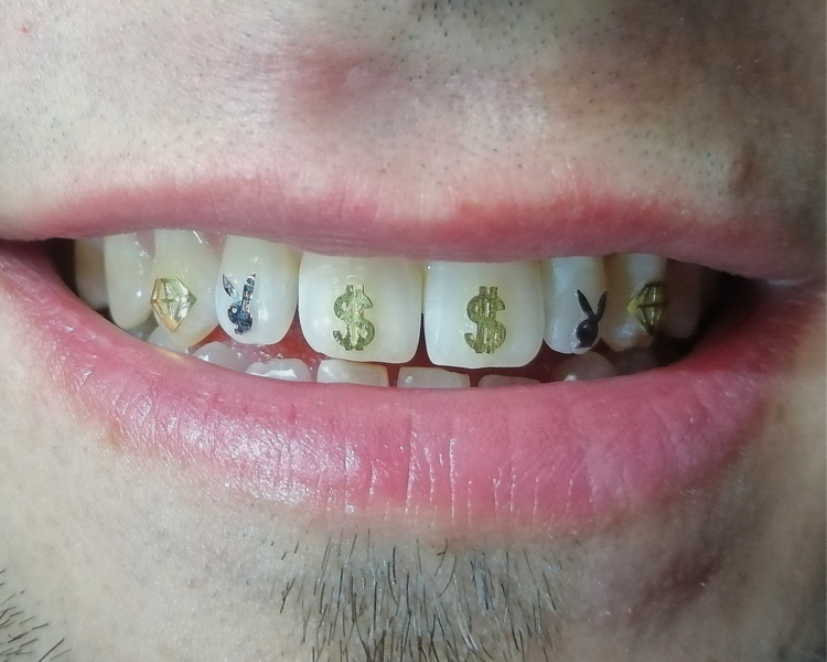 Gemas PLANAS con diseño