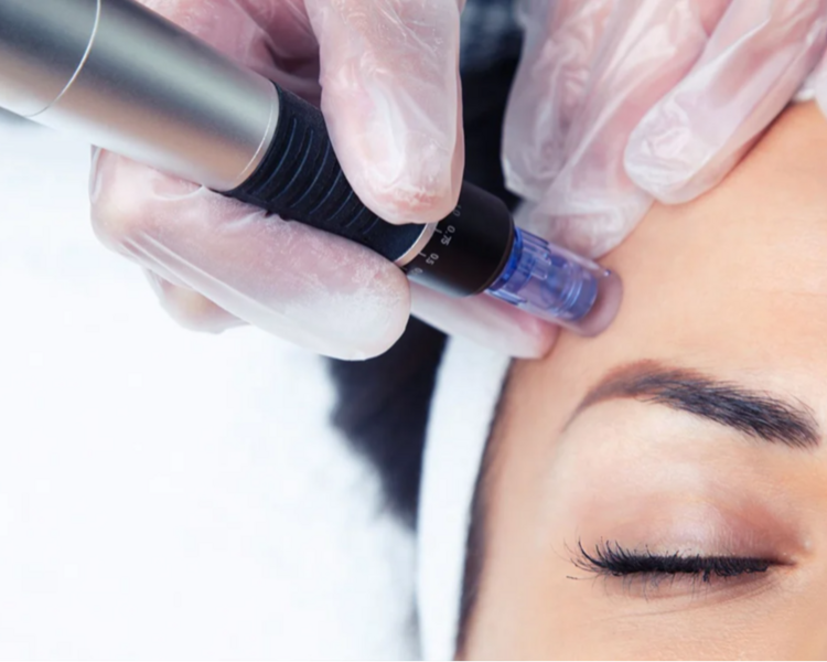 skin renewal 3s PRESALE