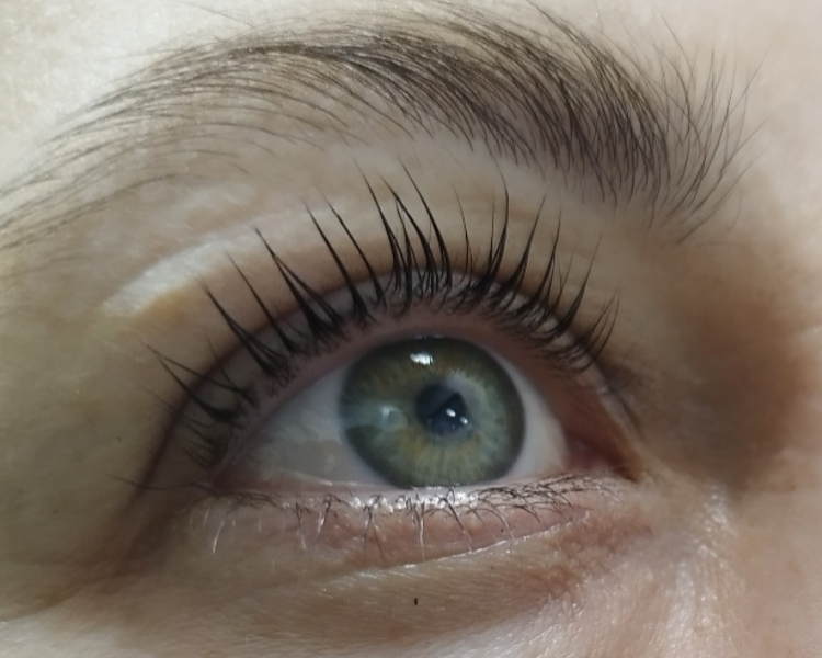 Lifting+ tinte + botox + vitaminas