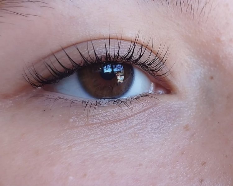 Reparación de lifting+ reversa+ botox+ vitamina 