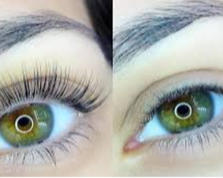 PROMO Lifting + Nutricion