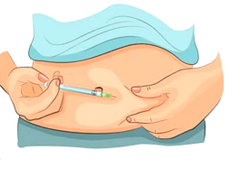 Inyección SUB CUTANEA