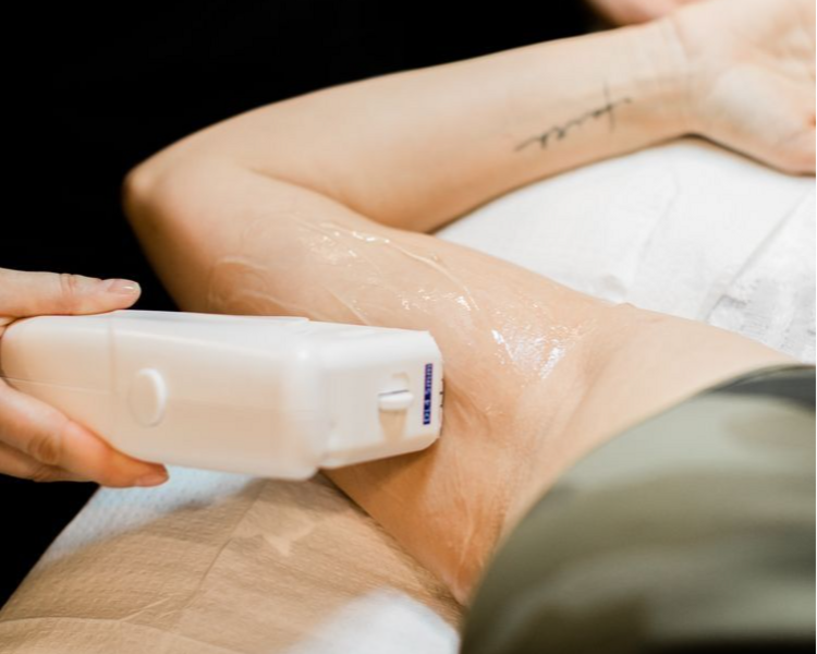 PACK DE DEPILACION LASE AXILAS + REBAJE FULL