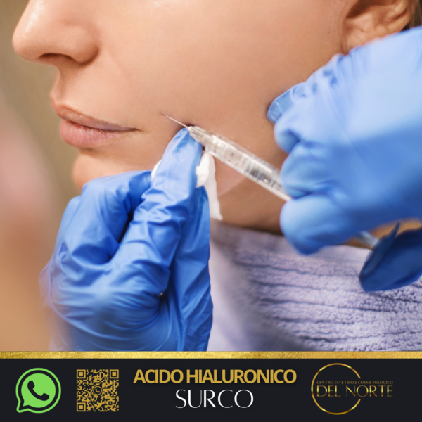 Ácido Hialuronico SURCOS 