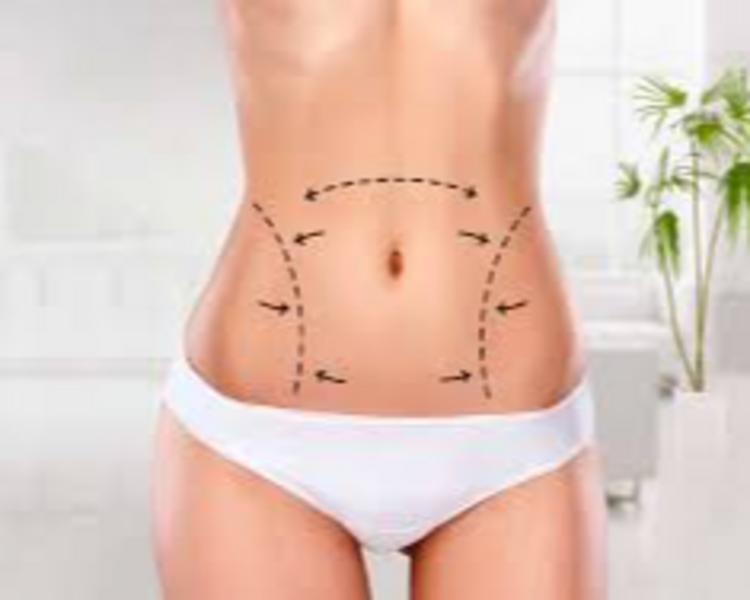 Reductivo Corporal Personalizado