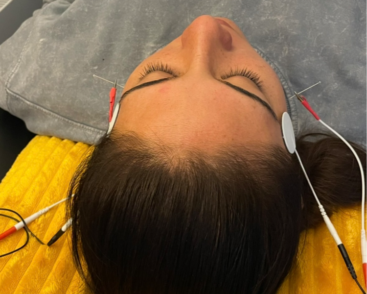 SESIÓN KINESICA MAXILOFACIAL - TRATAMIENTO 