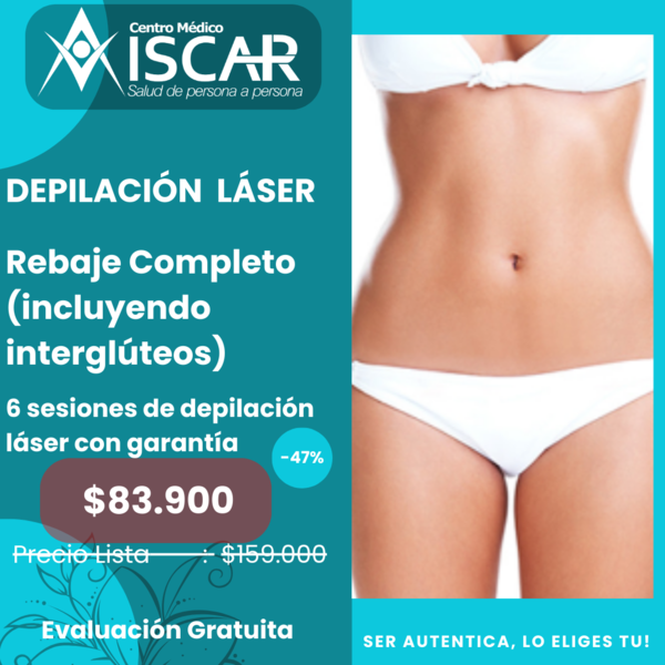 Rebaje Completo 