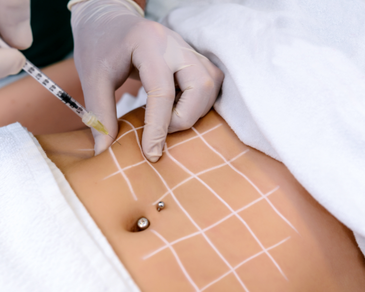 Paquete Reductivo Slim Balance