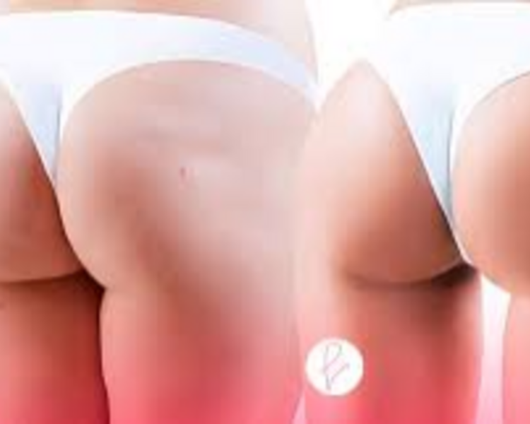 Paquete de Gluteos Pro Lift