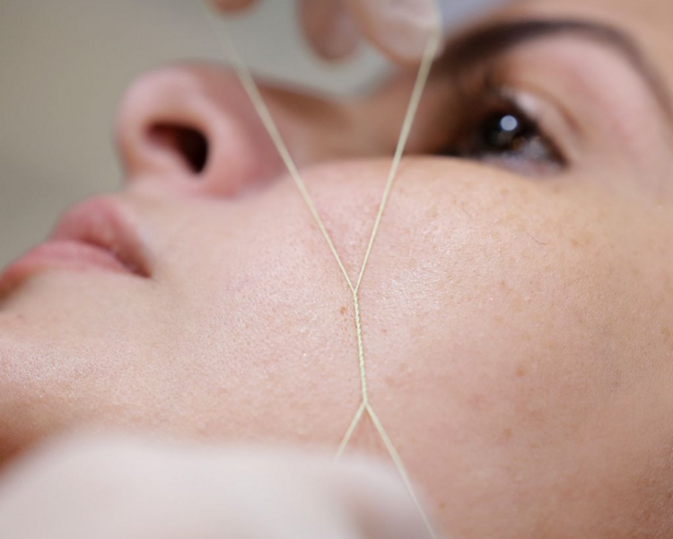 Depilación facial con hilos 