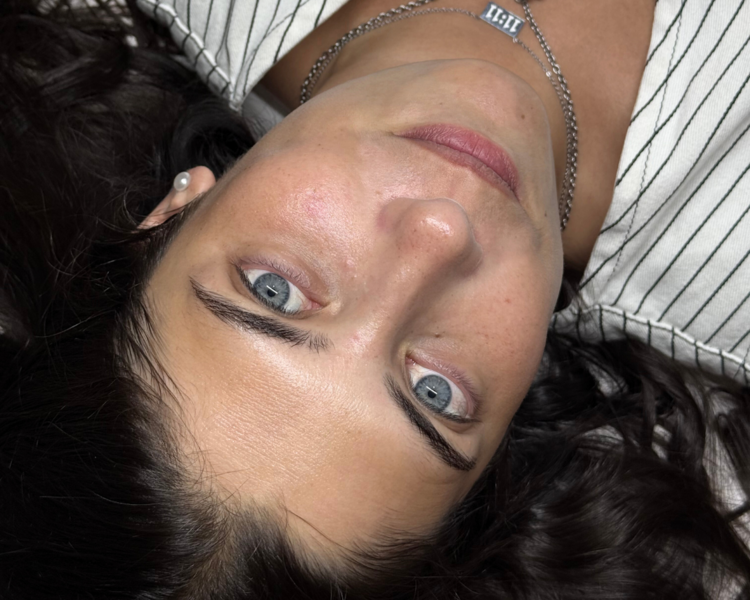 TOTAL SKIN RENEWAL —  Limpieza + Dermaplaning + Peeling