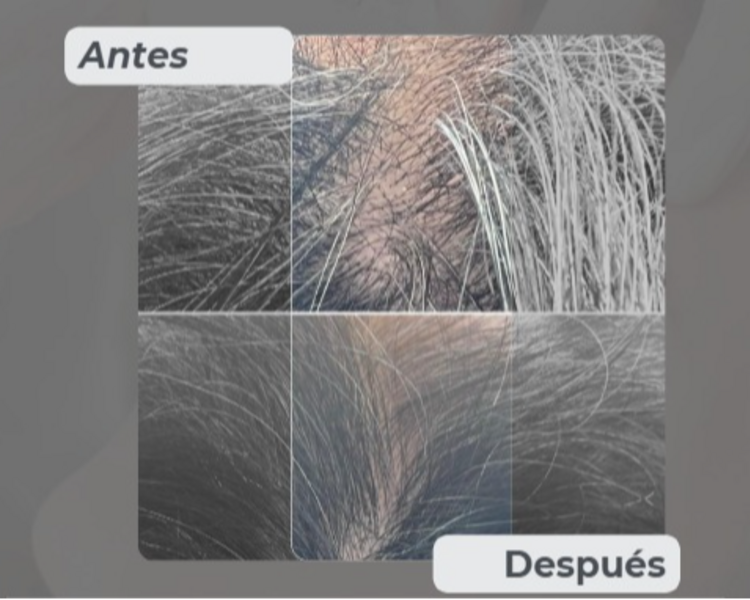 Bioregenerador Capilar