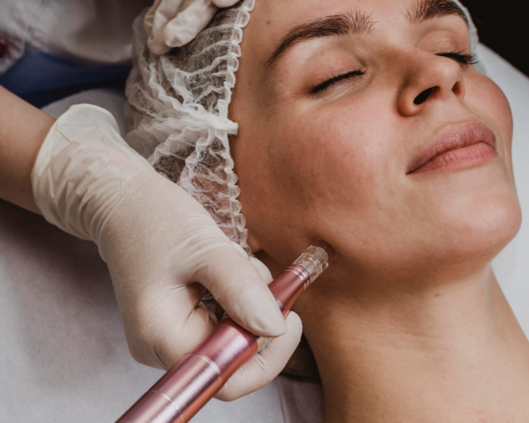 DERMAPEN CÉLULAS MADRE