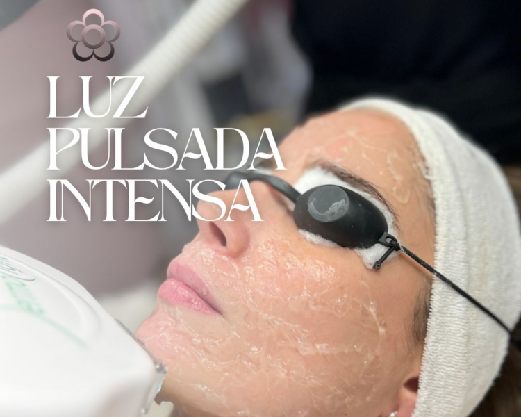 DEPILACION FACIAL IPL X 4