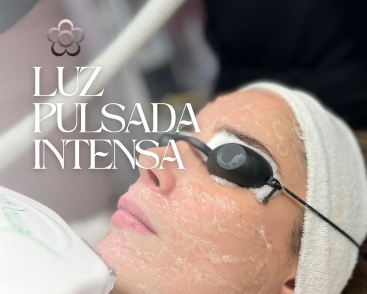 DEPILACION FACIAL IPL X 6