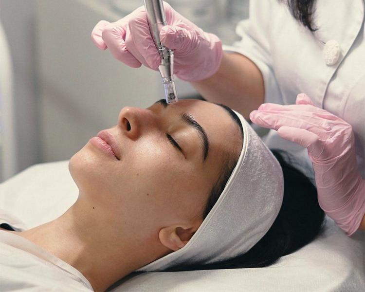 PRP FACIAL 