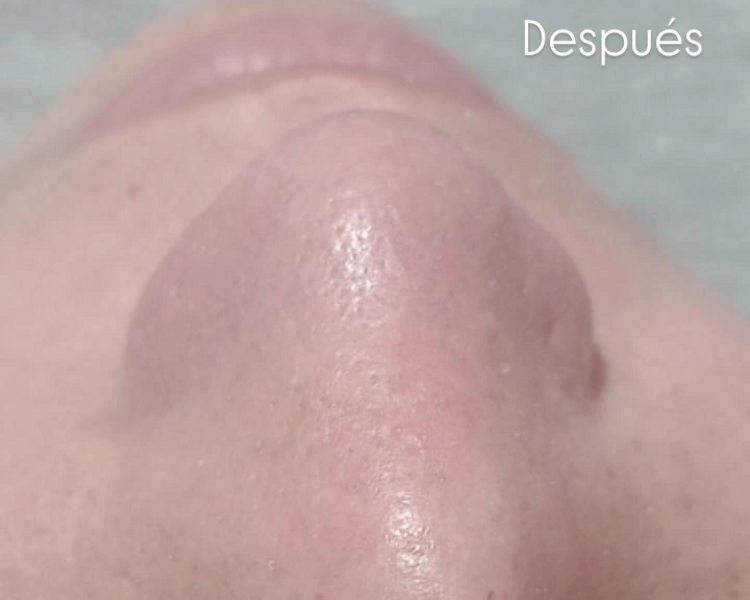 ✨ Tratamiento Facial Personalizado 