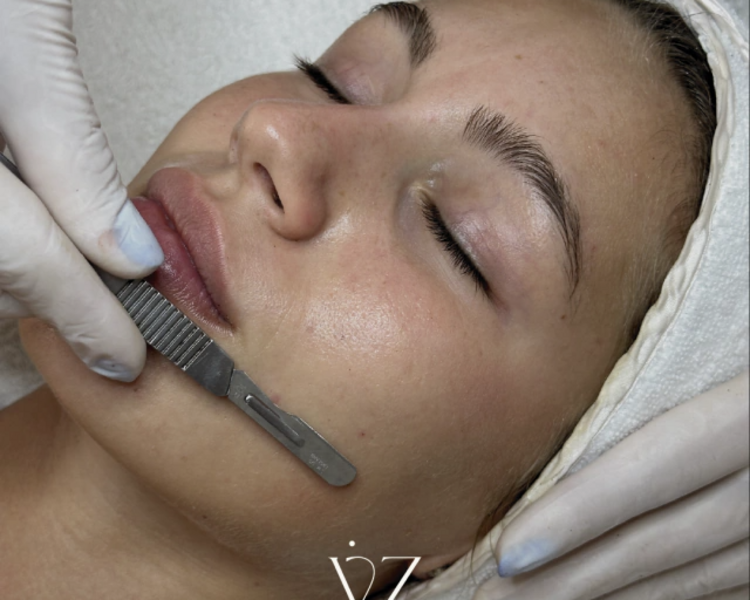 LIMPIEZA FACIAL PROFUNDA CON DERMAPLANING