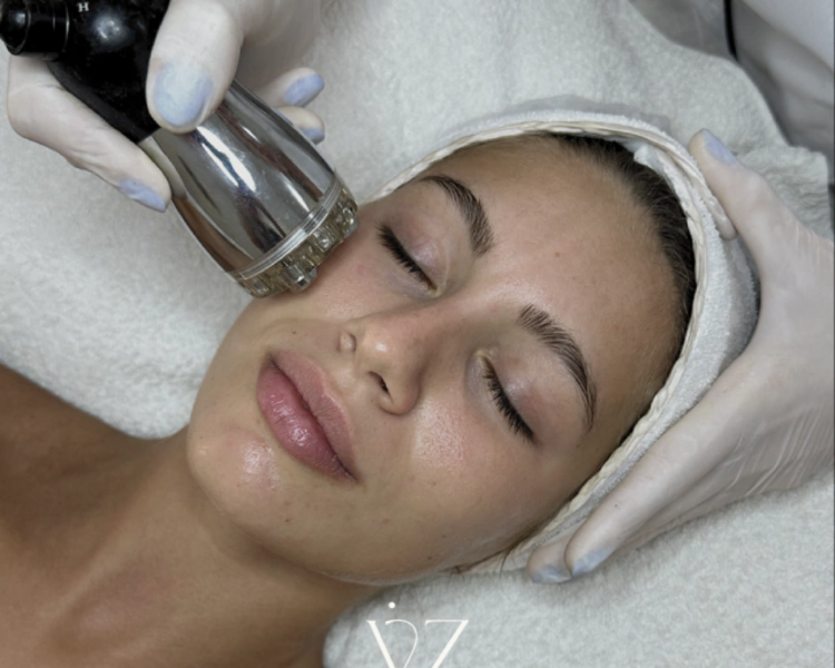 RADIOFRECUENCIA FACIAL