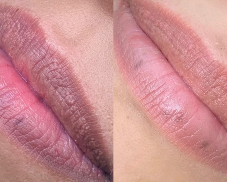 💋Neutralizacion de labios