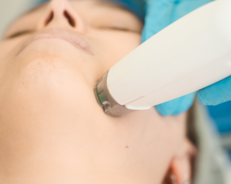 Radio Frecuencia FRAXFACE