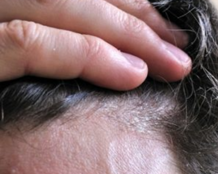 SCALP DETOX "Caballero"