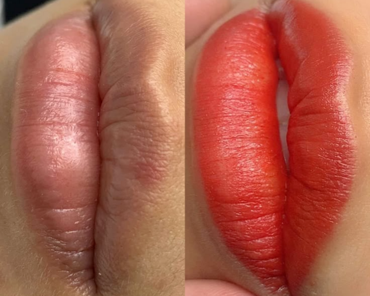Neutralización y micropigmentación de labios