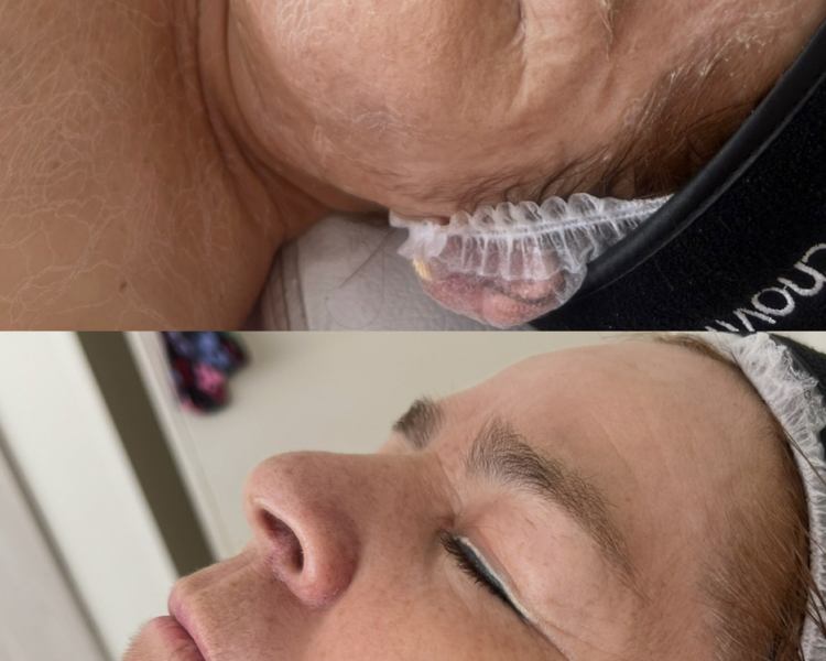 Ritual tensor facial 