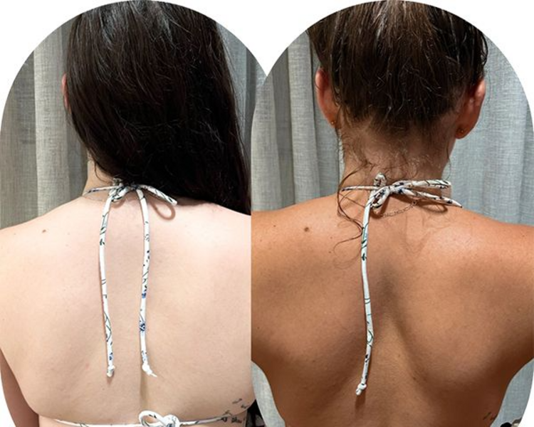 Bronceado instantaneo medio cuerpo