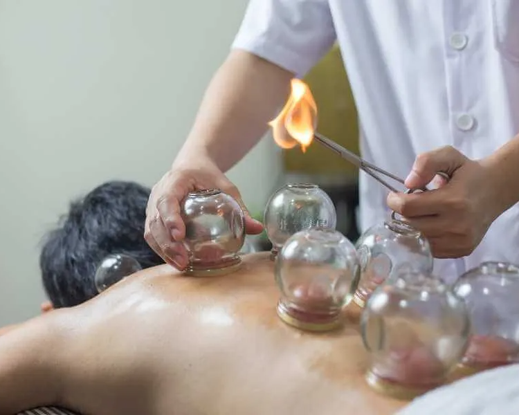 Masaje Tui Na con ventosas