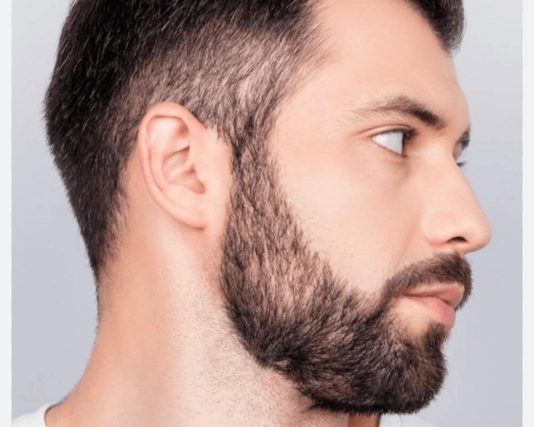 Perfilado de barba ( demarcación de barba ) 
