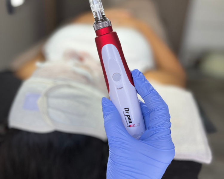 Dermapen LANZAMIENTO 15% off 