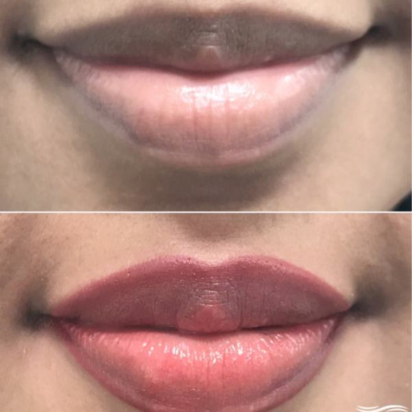 MICROPIGMENTACION DE LABIOS  