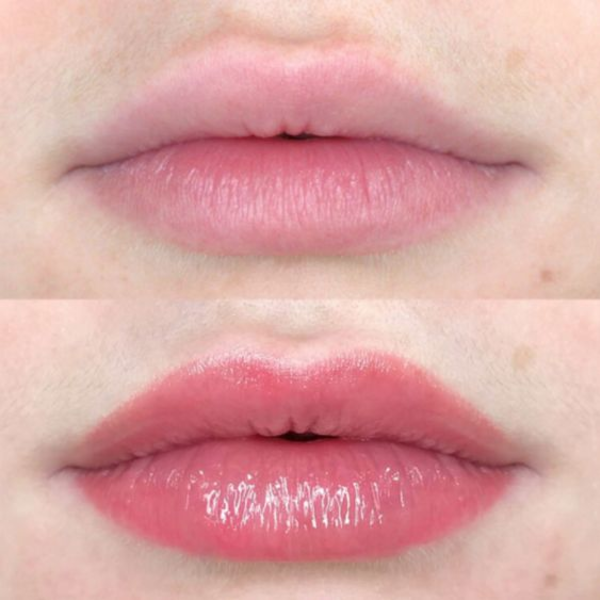 Labios Micropigmentación