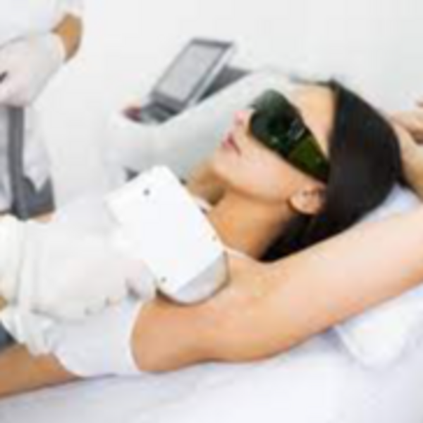 DEPILACIÓN AXILAS LASER 5 