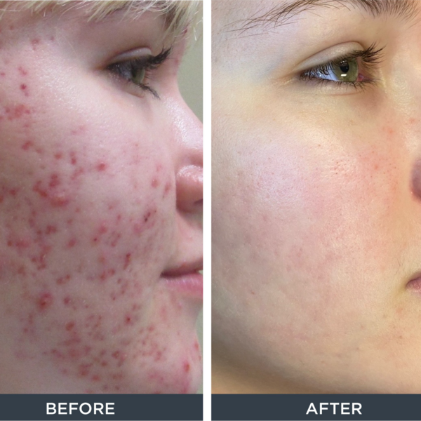 Sesion: Anti texturas y Arrugas! 