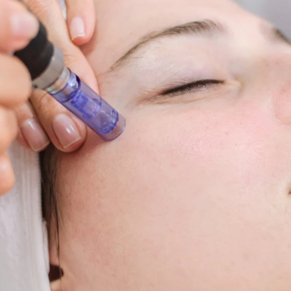 Servicio: Ojeras OFF con facial completo 