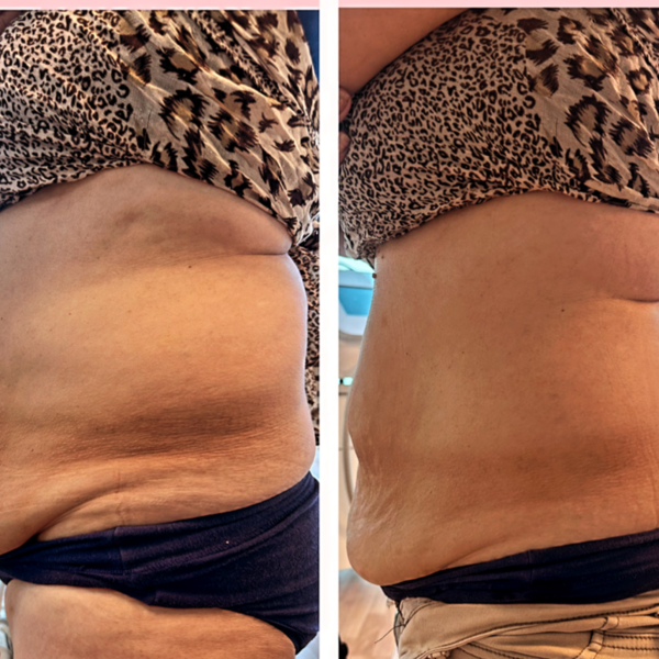 EVALUACIÓN REDUCTIVO