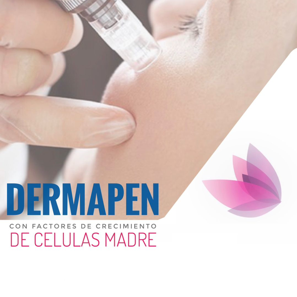 Microdermoabrasión Facial con Dermapen 