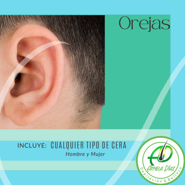 Orejas