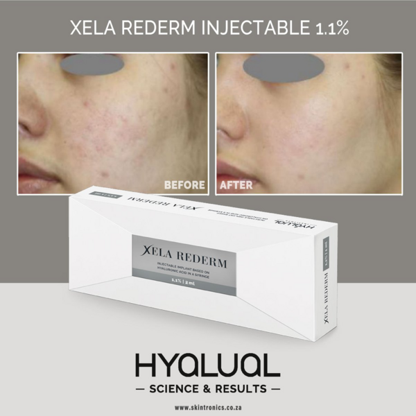 Xela Rederm® Tratamiento de ojeras