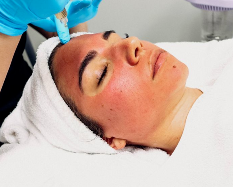 Plasma Rico en Plaquetas