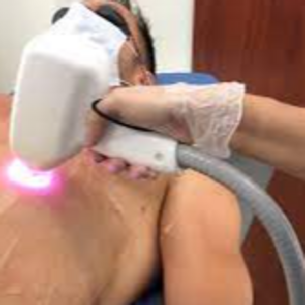 DEPILACIÓN LASER 5 SESIONES ESPALDA 