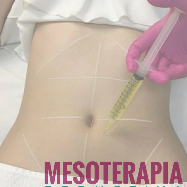 Mesoterapia Reductiva Corporal 